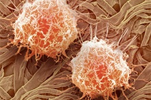 Urological Oncology (Cancer)